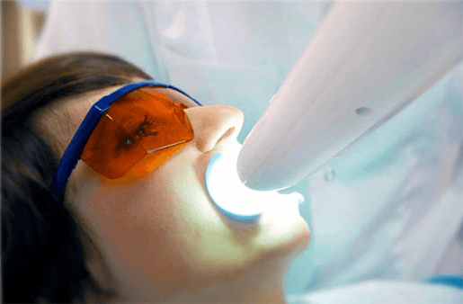 Understanding the Causes of Teeth Sensitivity Didcot