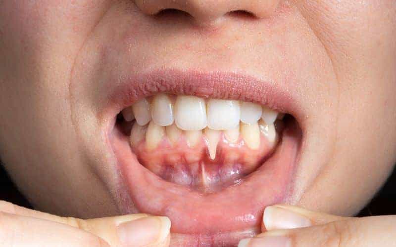Final Thoughts: Building Lifelong Enamel Protection Habits Didcot