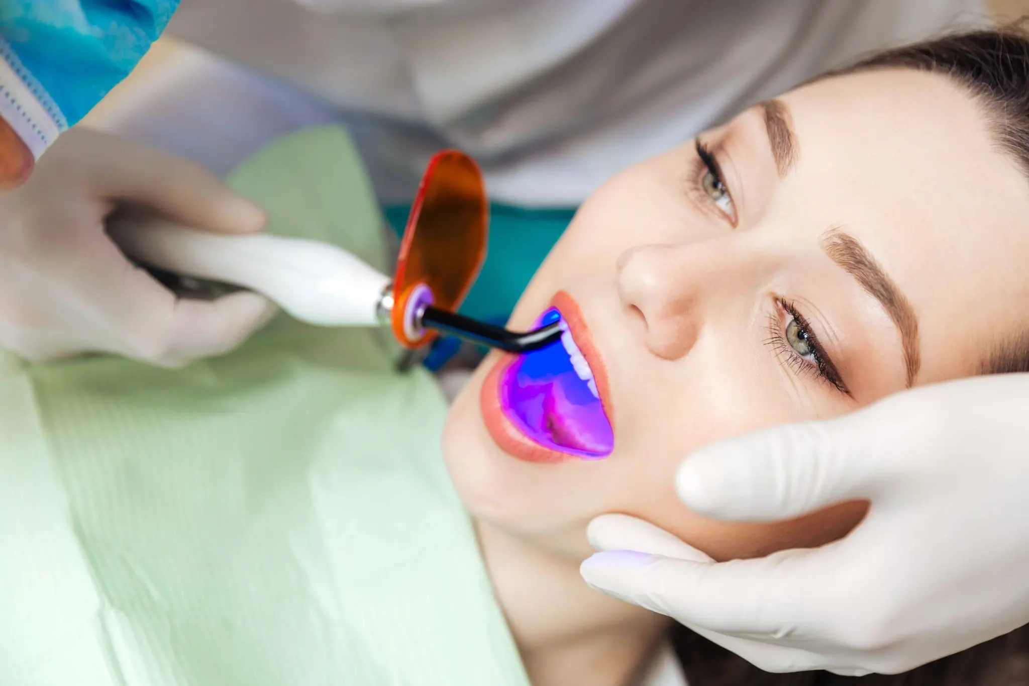 How Do You Choose the Right Teeth Whitening Didcot Option for Your Smile?