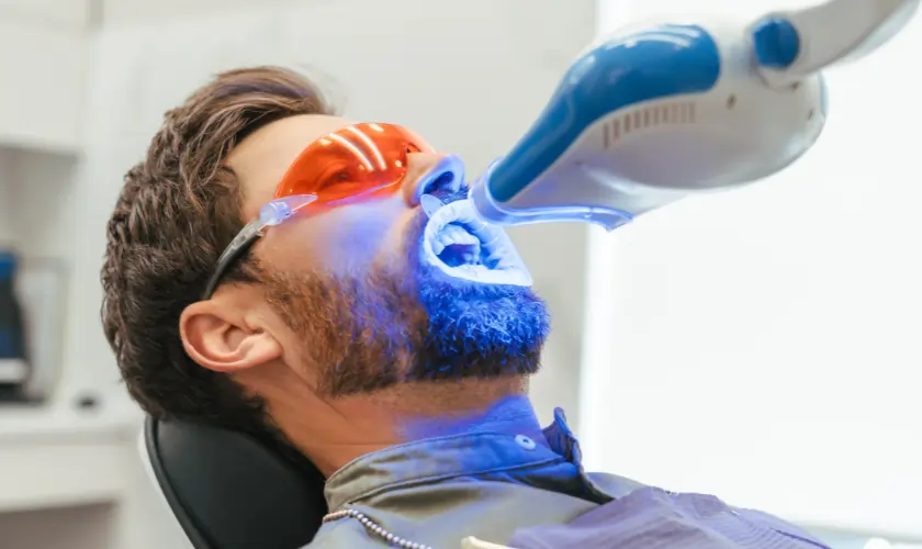 The Hidden Differences Between DIY and Professional Teeth Whitening Didcot