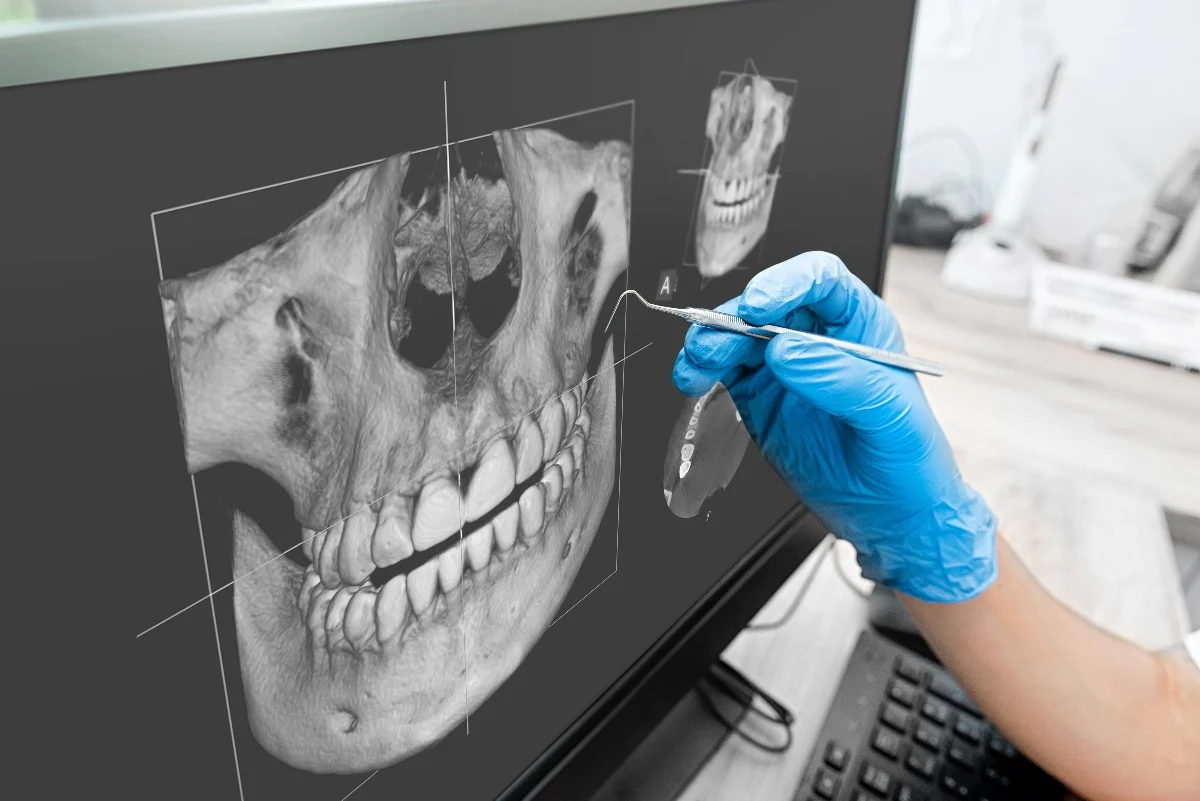 How Is AI Transforming Dental Treatment Planning Didcot?