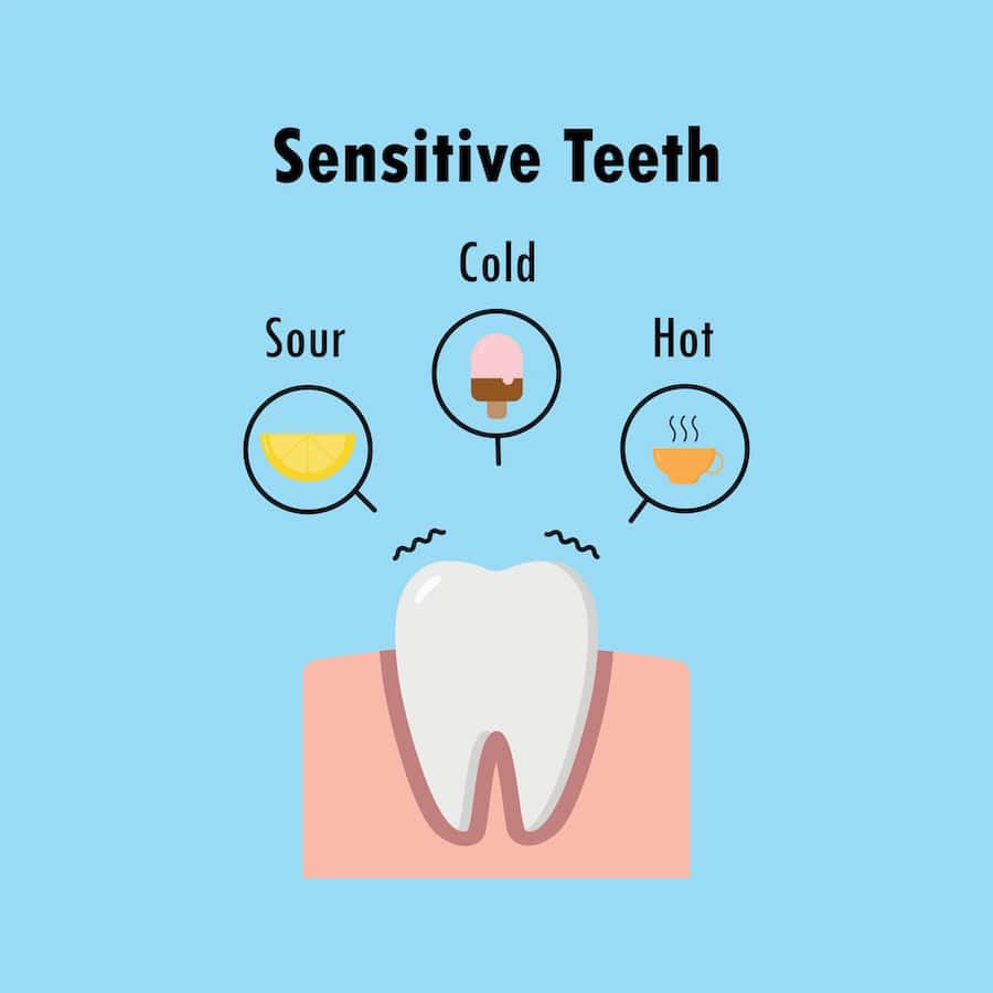 How Can You Tell If Your Teeth Are Becoming Sensitive Didcot?