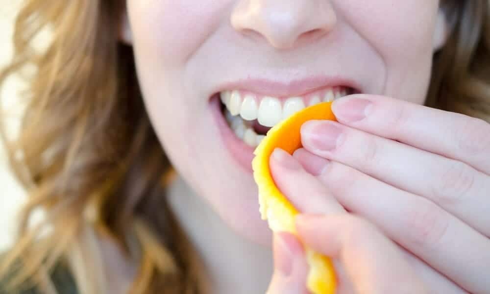 Are DIY Teeth Whitening Remedies Safe for Your Teeth and Enamel Didcot?