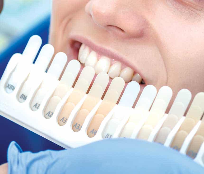 Is Laser Teeth Whitening Worth It for a Brighter, Confident Smile Didcot?