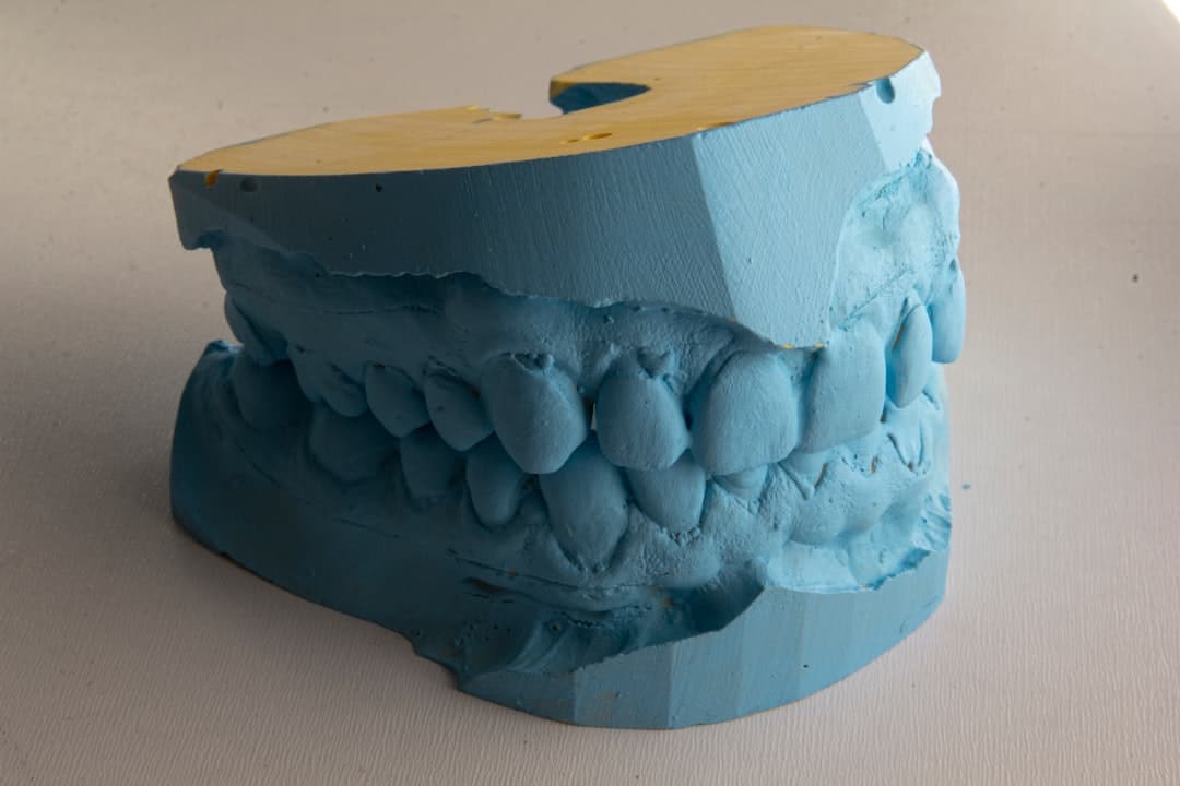 How Do Dental Implants Improve Jawbone Health and Oral Function Didcot?
