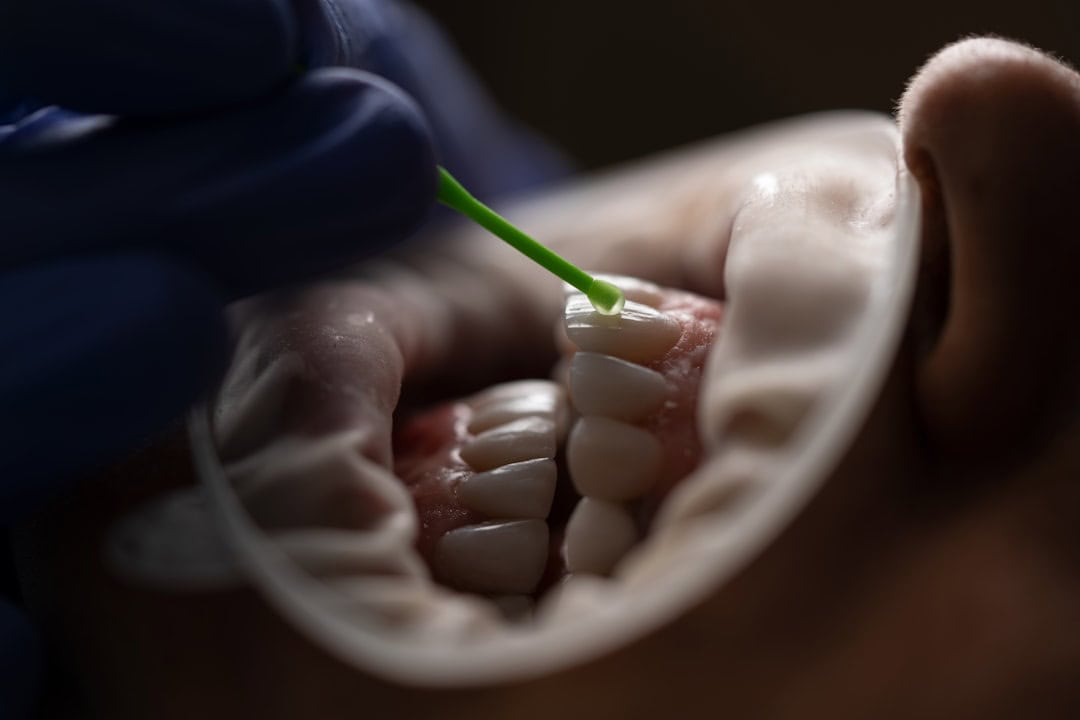 Common Causes of Persistent Dry Mouth Didcot
