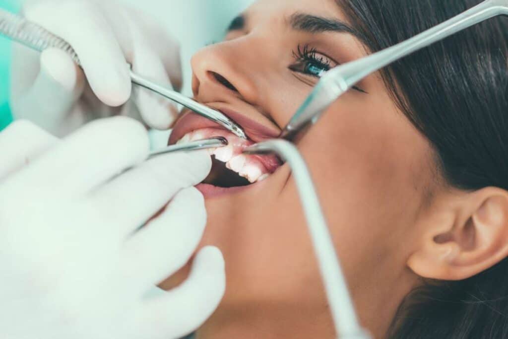 Braces Are Just for Kids – Myth or Reality Didcot