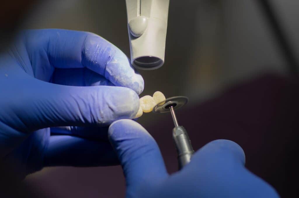 Customised Dental Solutions: Crowns, Aligners, and Implants Didcot