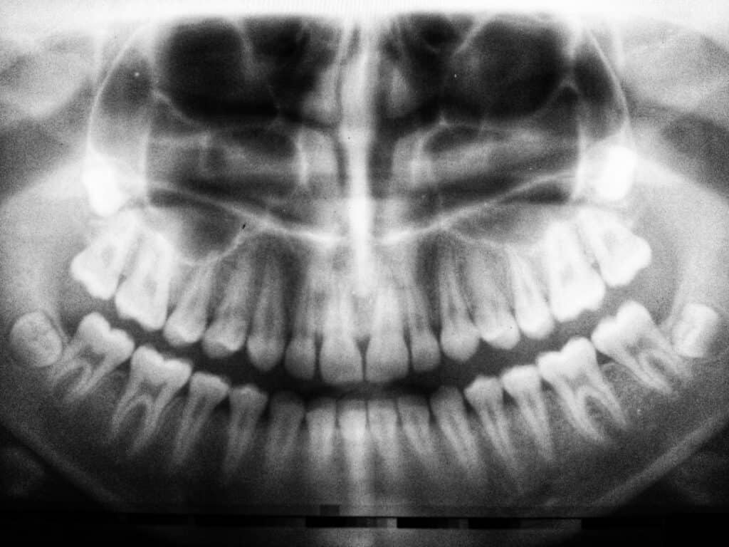 The Future of 3D Printing in Oral Healthcare Didcot